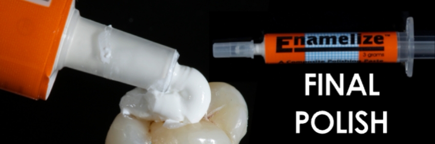 Finishing the Direct Posterior Composite Restoration: A Visual Essay Smithson finishing direct posterior composite 10
