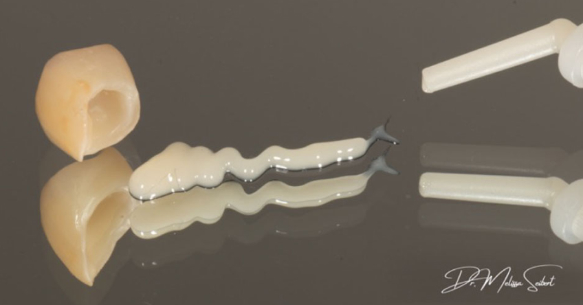 A Crash Course in Dental Cements for Restorative Procedures Seibert crash course dental cements 02