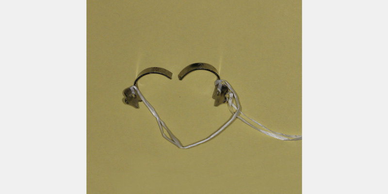 efrver Fractured rubber dam clamp retained by a floss ligature after breaking at the bow