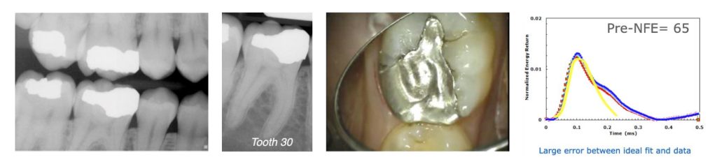 9939 Digest Percussion Fig 2