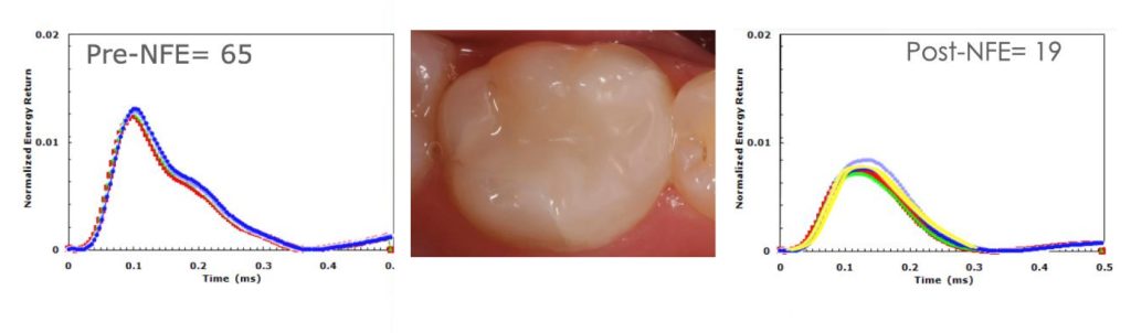 9939 Digest Percussion Fig 3