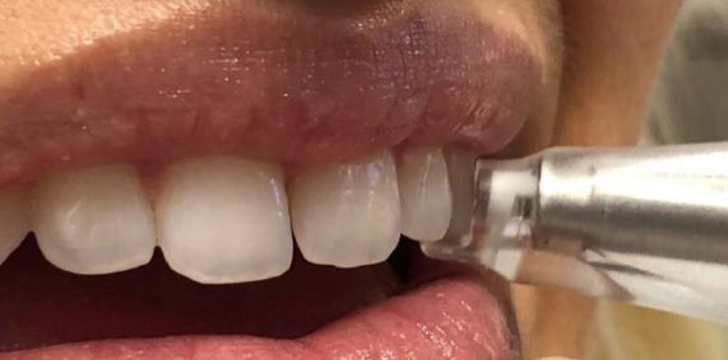 9939 Digest Percussion Fig 5