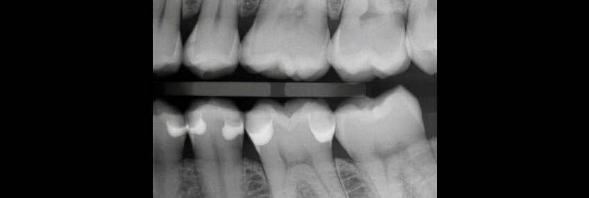 Smithson closing the class 2 box p3 04 1