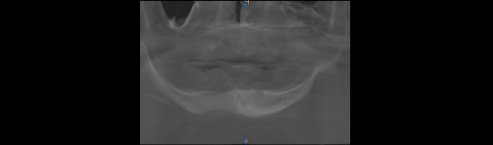 10112 Digest Digital Dentures Fig 21