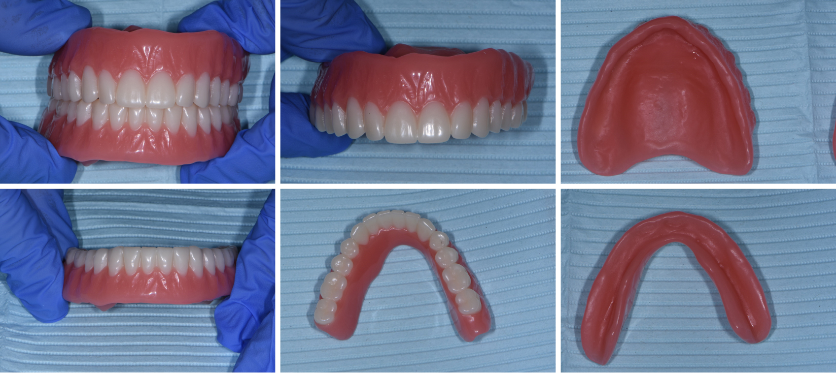 10112 Digest Digital Dentures Figs22 27