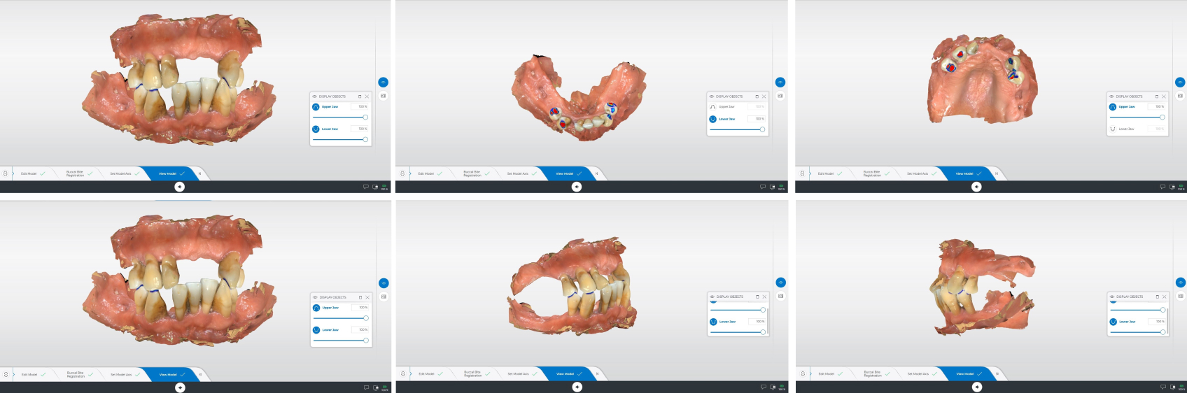 10112 Digest Digital Dentures Figs9 14