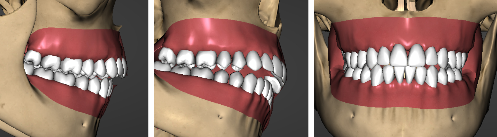 9968 Digest Occlusion Exam Fig 1