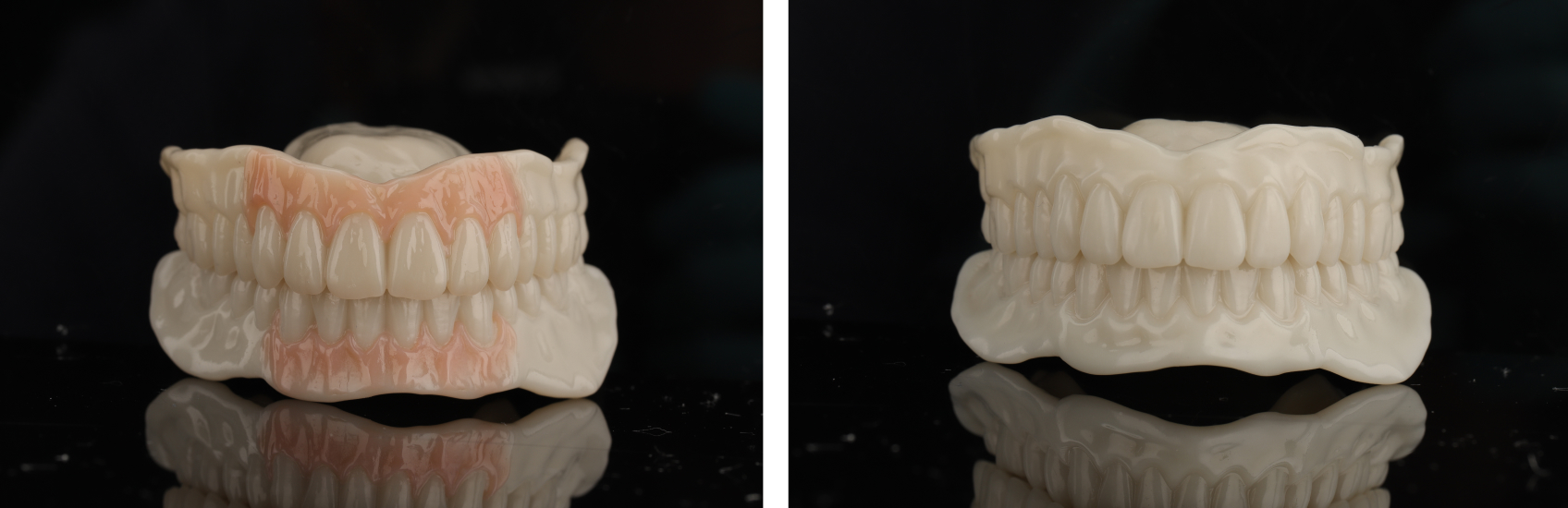 9971 Digest Reference Denture Fig 13 14