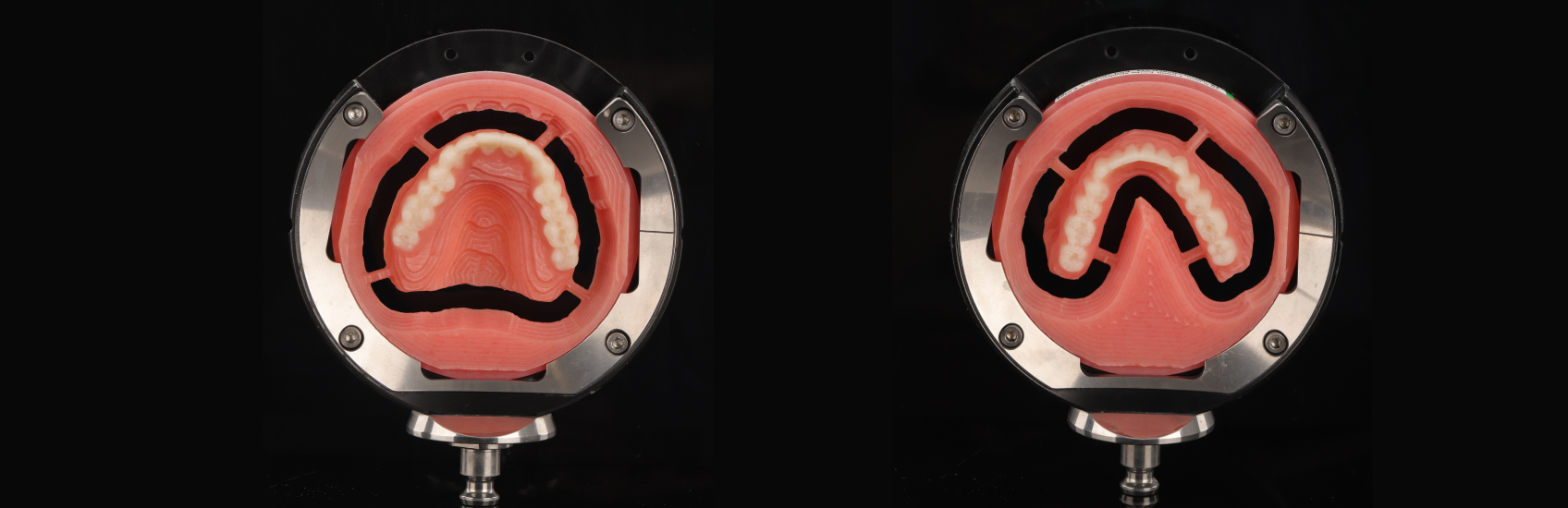 9971 Digest Reference Denture Fig 20 21