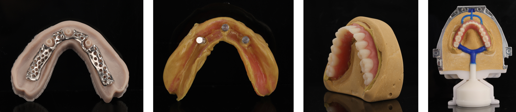 9971 Digest Reference Denture Fig 27 30
