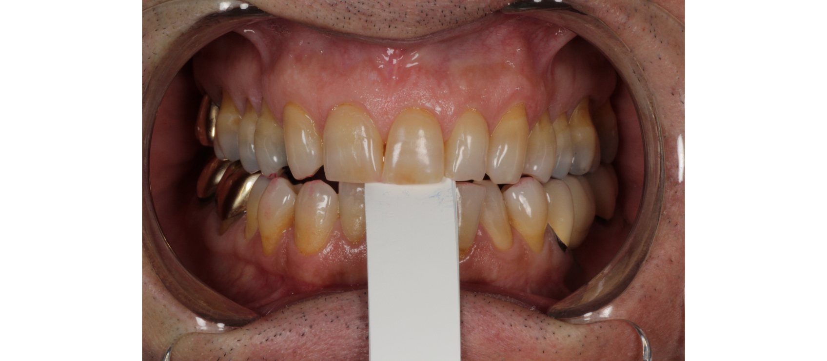 9972 Digest Kwon Fig 3