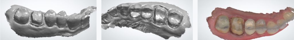 9974 Digest Labs Fig 1 3