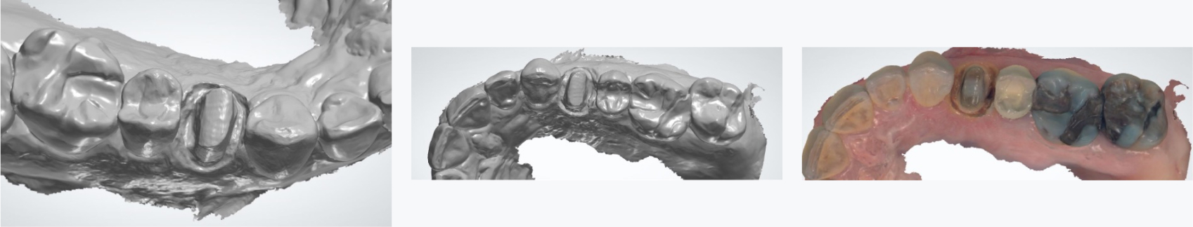 9974 Digest Labs Fig 4 6