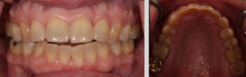 Flash Systems for Dental Photography Andy Janiga Flash Systems Chart Fig3a 3b