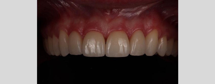 Flash Systems for Dental Photography Andy Janiga Flash Systems Chart Image Fig5