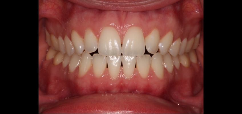 AndyJaniga DentalPhotography101 Fig.10