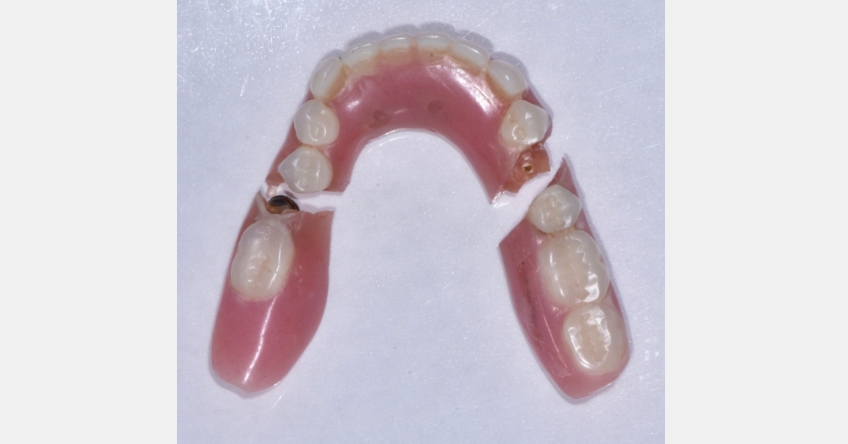 Restorative Space for Locators: How Much is Enough? Benting restorative space locaters 04