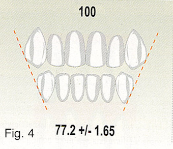 Understanding the Bolton Ratio Cheryl DeWood Understanding the Bolton Ratio Figure 4