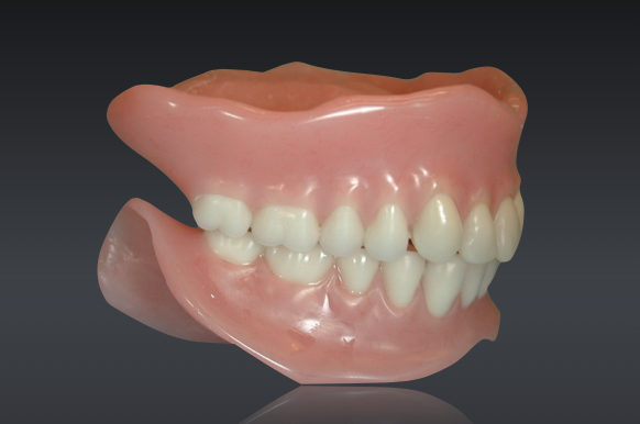 Conventional Complete Denture Fabrication in 9 Steps Darin Dichter Conventional Complete Denture Fabrication in 9 Steps Featured Image