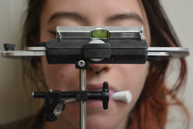 9 Steps to a Facebow Transfer Dave St Ledger 9 Steps to a Facebow Transfer Figure 10