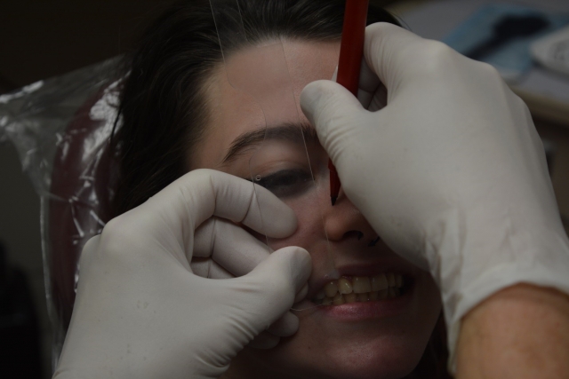 9 Steps to a Facebow Transfer Dave St Ledger 9 Steps to a Facebow Transfer Figure 6