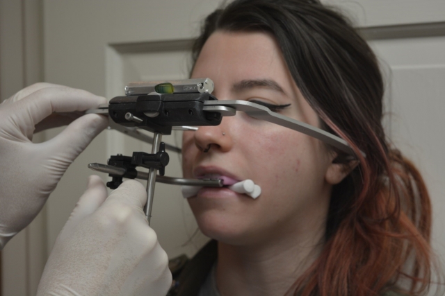 9 Steps to a Facebow Transfer Dave St Ledger 9 Steps to a Facebow Transfer Figure 9