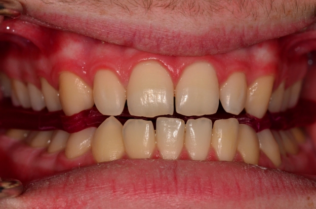 A Step-by-Step Guide to Fabricating the Protrusive Record Dave St. Ledger FabricatingtheProtrusiveRecord figure 10