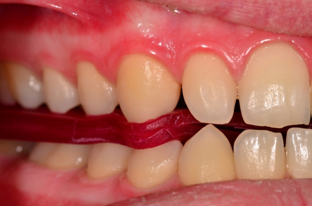A Step-by-Step Guide to Fabricating the Protrusive Record Dave St. Ledger FabricatingtheProtrusiveRecord figure 11