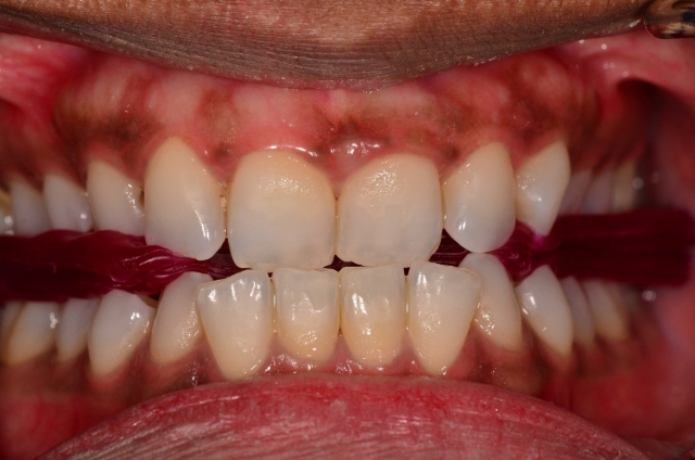 A Step-by-Step Guide to Fabricating the Protrusive Record Dave St. Ledger FabricatingtheProtrusiveRecord figure 12