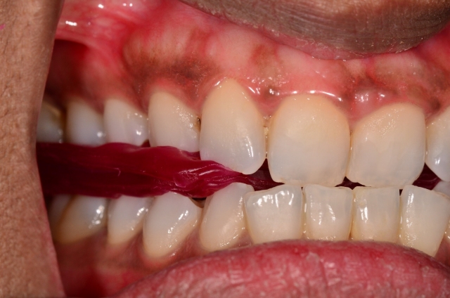 A Step-by-Step Guide to Fabricating the Protrusive Record Dave St. Ledger FabricatingtheProtrusiveRecord figure 13
