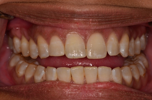 A Step-by-Step Guide to Fabricating the Protrusive Record Dave St. Ledger FabricatingtheProtrusiveRecord figure 14