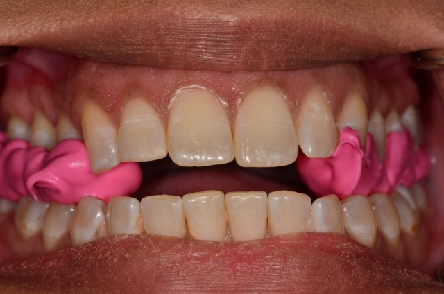 A Step-by-Step Guide to Fabricating the Protrusive Record Dave St. Ledger FabricatingtheProtrusiveRecord figure 15