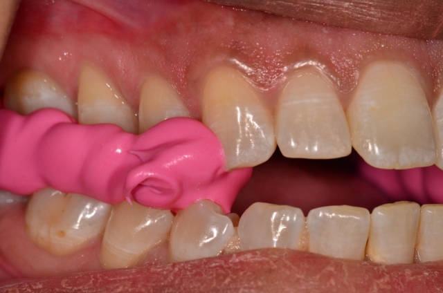 A Step-by-Step Guide to Fabricating the Protrusive Record Dave St. Ledger FabricatingtheProtrusiveRecord figure 16