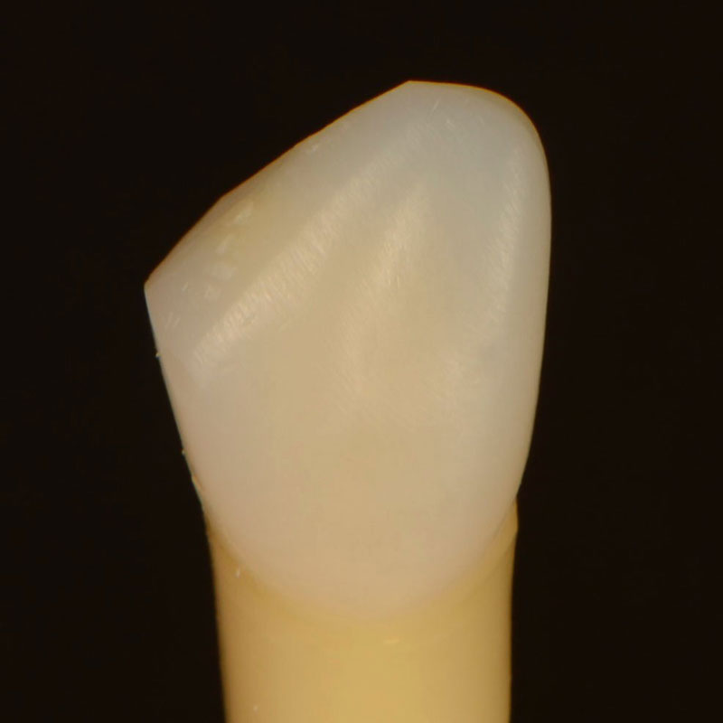 7 Common Problems with Layering Anterior Composites and How to Fix Them DawnWehking 7CommProbsLayeringAntComp Fig.3