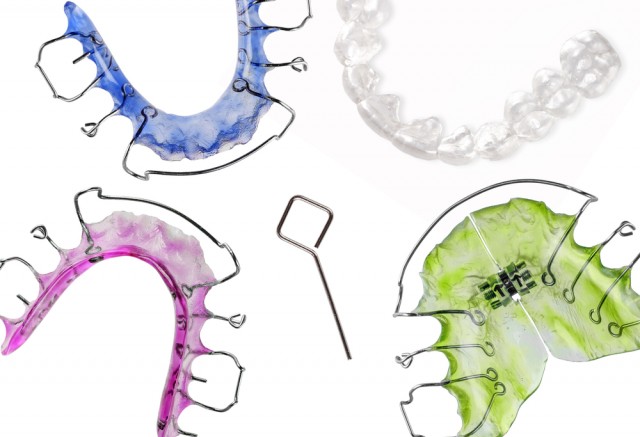 Donna Stenberg A Comparison of Orthodontic Retention Options featured image