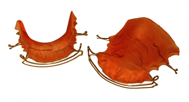 A Comparison of Orthodontic Retention Options Donna Stenberg A Comparison of Orthodontic Retention Options image1