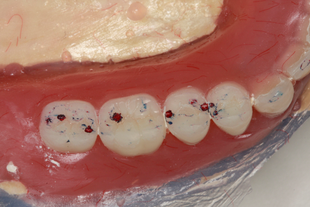 Doug Benting BULL Rule Or Is It a Guideline Featured Image