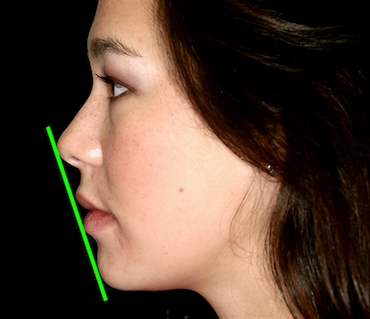 Frank Spear Evaluating Facial Esthetics The Esthetic Plane image 1
