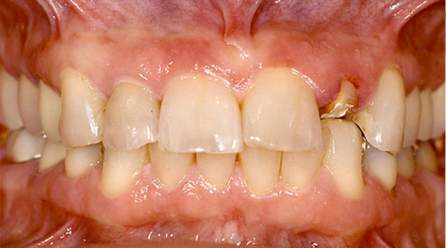 Frank Spear Muscle Deprogramming Featured Image