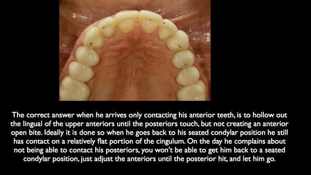 Frank Spear Muscle Deprogramming Figure 10