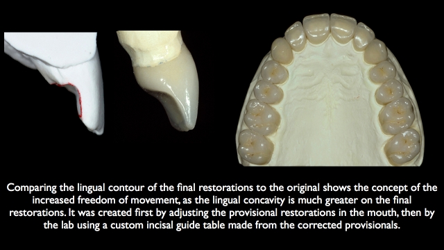 Frank Spear Muscle Deprogramming Figure 11