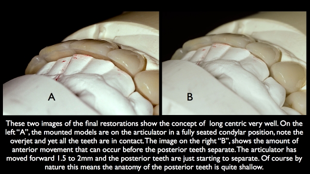 Frank Spear Muscle Deprogramming Figure 12