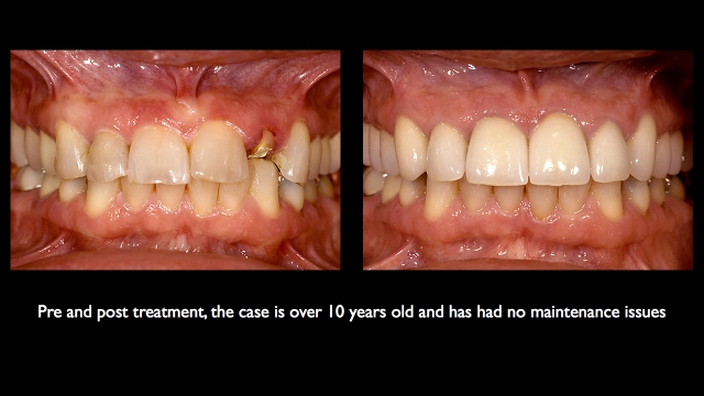 Frank Spear Muscle Deprogramming Figure 13