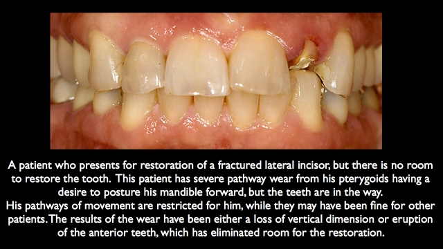 Frank Spear Muscle Deprogramming Figure 3