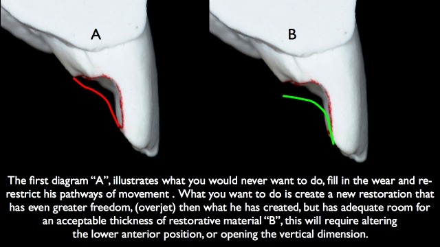 Frank Spear Muscle Deprogramming Figure 6