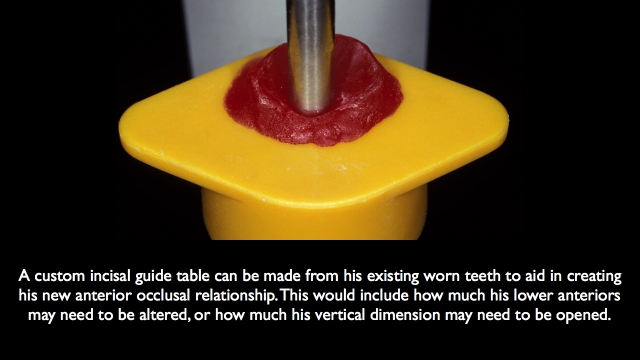 Frank Spear Muscle Deprogramming Figure 7