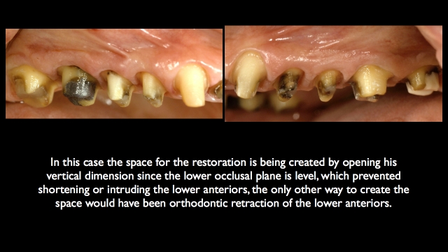 Frank Spear Muscle Deprogramming Figure 8