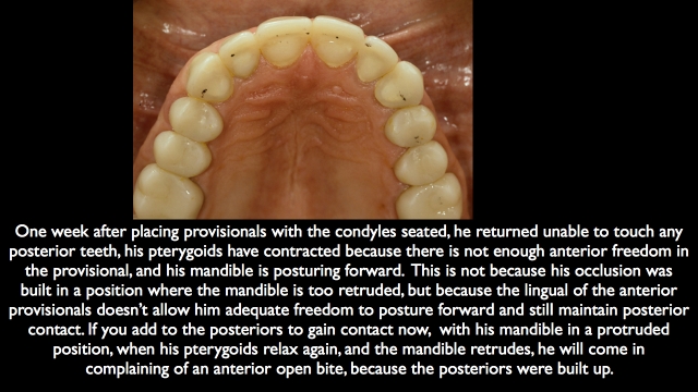 Frank Spear Muscle Deprogramming Figure 9