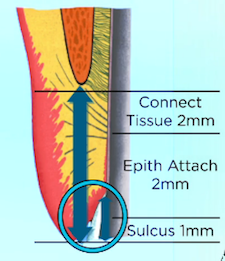 Frank Spear The Two Rules of Subgingival Margin Placement image1