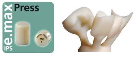 e.max: Bond or Cement? Gary DeWood e.max Bond or Cement fig 1